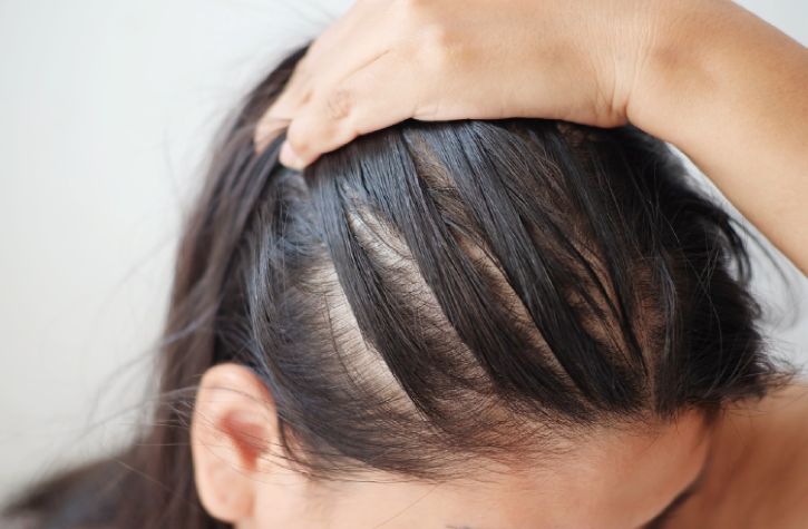 6 Astounding Benefits of Applying Ghee On Hair