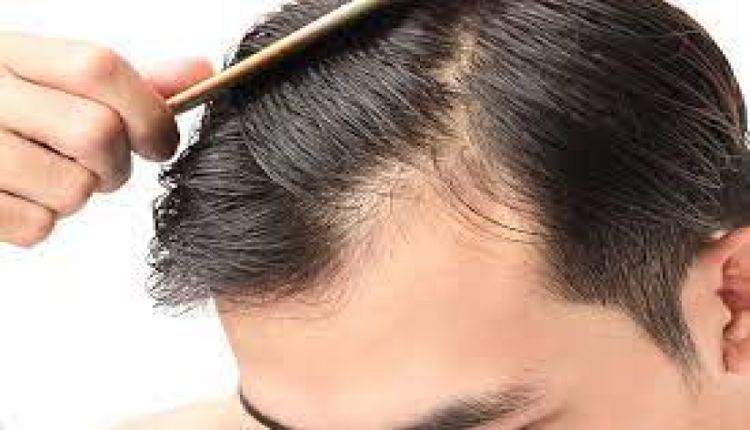 5 Ways To Stop Hair Fall In Teenage Boys