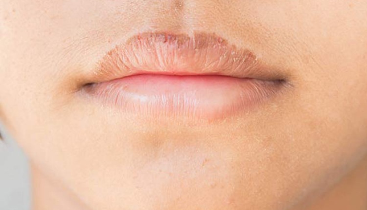 5 Most Impressive Natural Ways To Get Rid Of Dark Lips