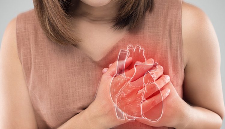  Coronary Artery Disease