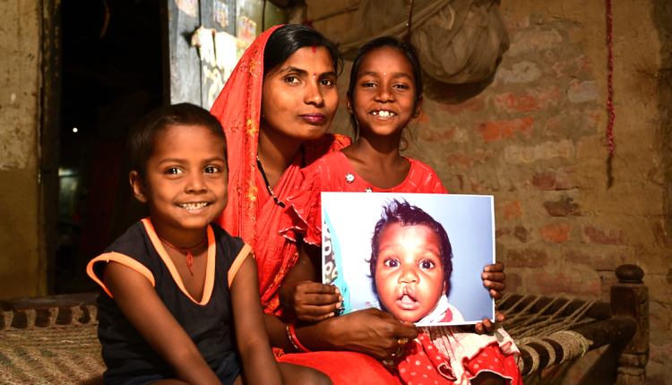 Diagnosis of Clefts